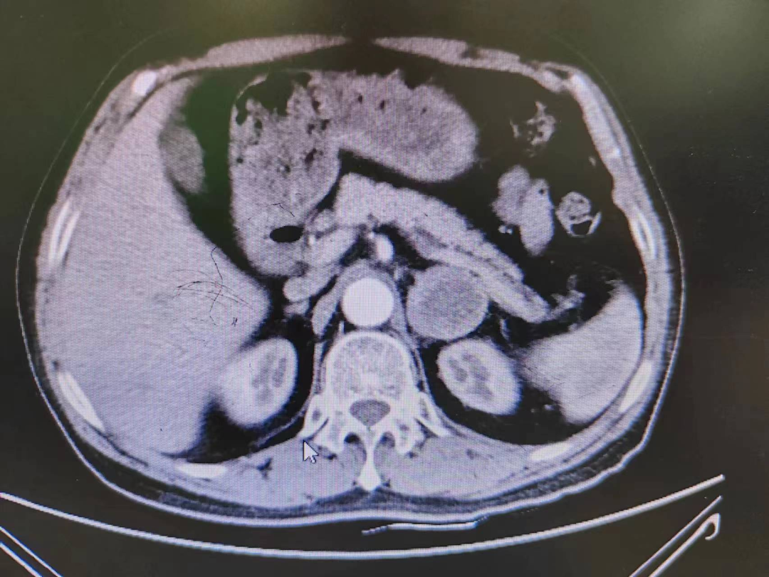 1691031646803545.png 640.png